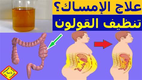 أسباب أخرى للإمساك