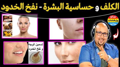 أسباب الحساسية المفاجئة على الوجه والعلاج بالمواد الطبيعية: