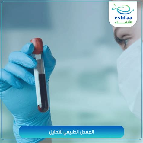 أسباب انخفاض مستوى الهيموجلوبين الطبيعي