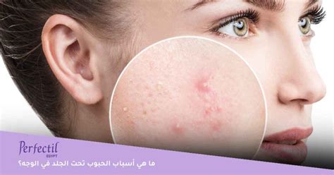 أسباب ظهور حبوب الشعر تحت الجلد في المنطقة الحساسة