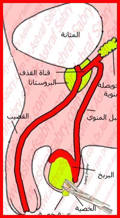 أضرار فائض المذي عند الرجال