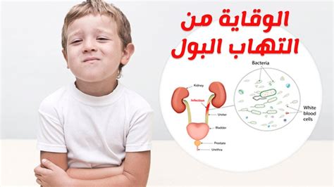 أعراض التهابات المسالك البولية عند الأطفال (علامات وأعراض التهاب المسالك البولية عند الأطفال) أعراض التهابات المسالك البولية عند الأطفال (علامات وأعراض التهاب المسالك البولية عند الأطفال)