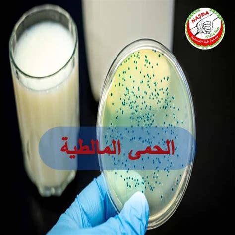 أعراض الزحار الذي تسببه بكتيريا الشيكيلا أعراض الزحار الذي تسببه بكتيريا الشيكيلا