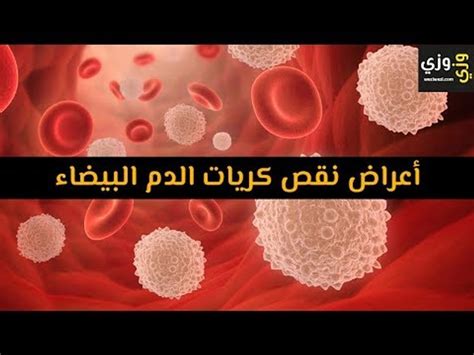 أعراض انخفاض خلايا الدم البيضاء في حالة الإصابة بالسرطان