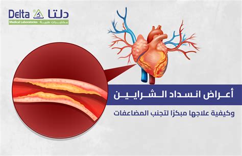 أغذية لتقليل انسداد الشرايين
