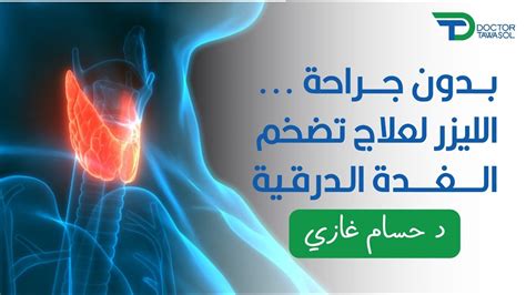 أغذية لعلاج تضخم الغدة الدرقية بدون جراحة