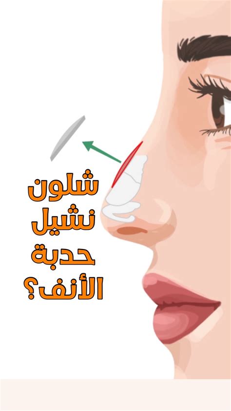 أما غمازات الأنف،