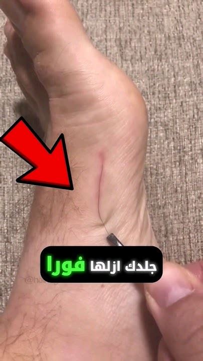 إذا رأيت ذبابة تحاول إزالة ما عالق بجسمها، إذن