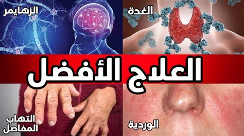 إرشادات لتحقيق العلاج الفعال والوقاية من أمراض المناعة الذاتية