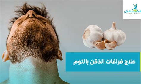 استخدام الثوم للشعيرات وشرح طريقة فرك الذقن بالثوم