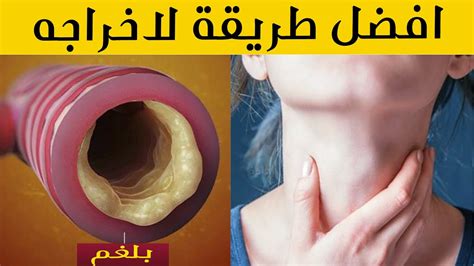 اضرار تراكم البلغم في الحلق