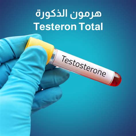 اكتشفي موعد إجراء اختبار هرمون الذكورة عند الرجال اكتشفي موعد إجراء اختبار هرمون الذكورة عند الرجال