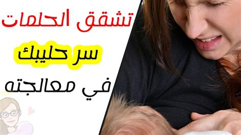 الأسباب التي تؤدي إلى تشقق الحلمات أثناء الرضاعة الطبيعية