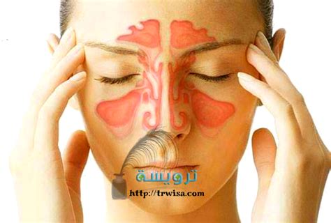 الأسباب المؤدية للإصابة بالتهاب الجيوب الأنفية