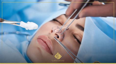 الأشخاص الذين تم ترشيحهم لعملية رأب الحاجز الأنفي