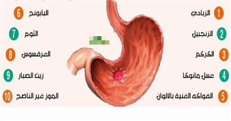 الأطعمة التي يمكنك تناولها أثناء الشعور بالمرض من التهاب المعدة