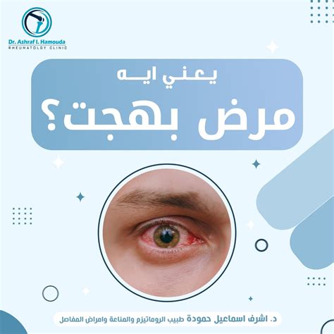 الأعراض التي قد تحدث أثناء العلاج بجلوكوفاج XR: