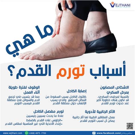 الأنشطة الرياضية التي تساعد في تقليل حدوث تورم القدم