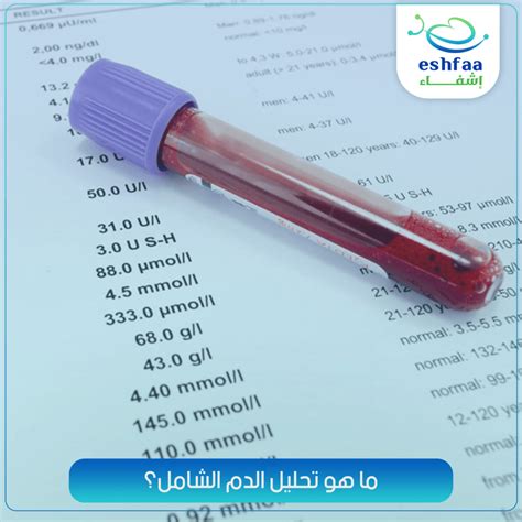 الاحتياطات المطلوبة قبل إجراء تحليل كرات الدم الحمراء الاحتياطات المطلوبة قبل إجراء تحليل كرات الدم الحمراء