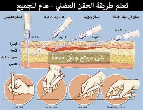 الاحتياطات الواجب مراعاتها قبل أخذ حقنة سوء فهم
