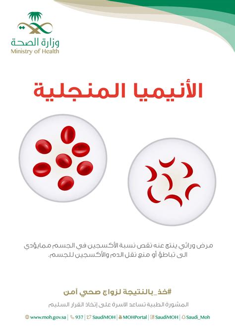 الاختلافات الأخرى بين حامل الخلايا المنجلية والشخص المريض