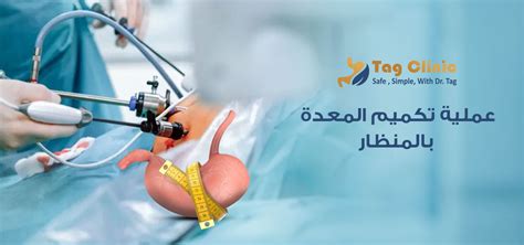 التعليمات التي يجب اتباعها قبل إجراء عملية تكميم المعدة بالمنظار