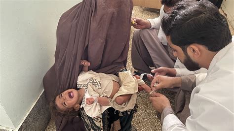 الفقر مع سوء التغذية