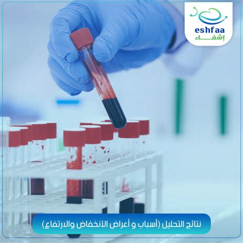 الوقاية والعلاج من انخفاض نسبة الهيموجلوبين في الدم