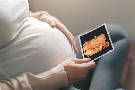 تجارب الولادة الطبيعية والولادة القيصرية في مستشفى سليمان فقيه