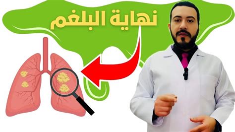 تخلص من البلغم نهائيا