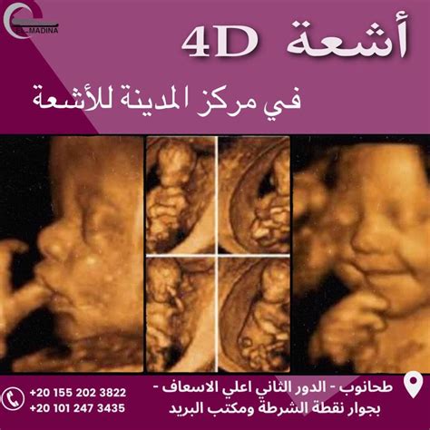 تصوير الجنين بالموجات فوق الصوتية في الأسبوع التاسع والعشرين