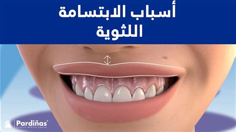 تظهر أعراض الظلم عندما تبتسم كأنك مليئة بالارتياح