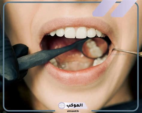 تفسير حلم رؤية الأسنان لابن سيرين - موقع فكرة