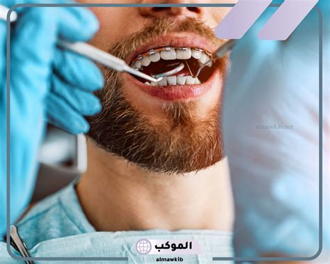 تفسير خلع الأسنان في المنام كامل لامرأة عزباء