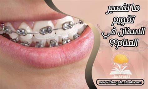 تفسير رؤية أسنان فضفاضة في المنام للمرأة المتزوجة