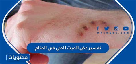 تفسير عض الميت للحي في المنام كامل للإمام الصادق