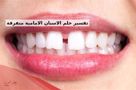 تفسير كيف تنهار الأسنان الأمامية في المنام لفتاة واحدة
