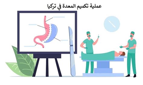 تكميم المعدة معلومات مهمة تحتاج إلى معرفتها قبل الجراحة تكميم المعدة معلومات مهمة تحتاج إلى معرفتها قبل الجراحة