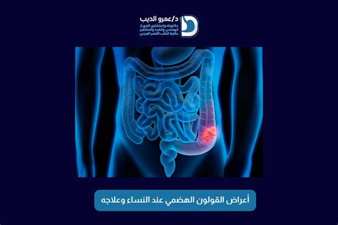 توصيات ومقترحات للوقاية من أعراض القولون العصبي والجهاز الهضمي