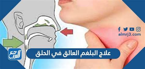 ثالثًا: نصائح إضافية لطرد البلغم