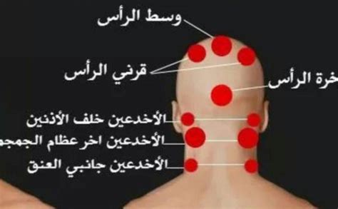 جواب سؤال حول فوائد الحجامة في الراس | مجلة جميلة جواب سؤال حول فوائد الحجامة في الراس | مجلة جميلة