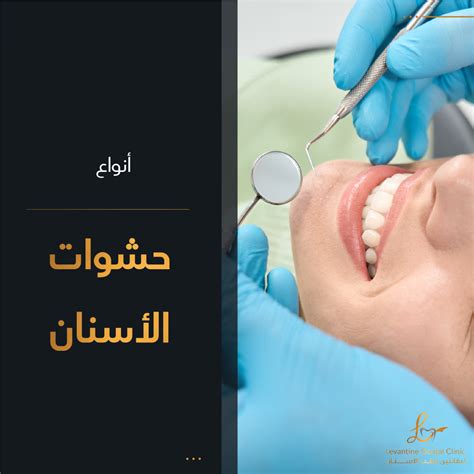 حشوات الاسنان بالاسمنت الابيض - يستخدم الاسمنت السني في حشوات الاسنان بالاسمنت الابيض