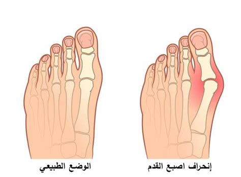 حل للواجبات الواردة في حتمية إصبع القدم العدوانية: الكرم والكرم