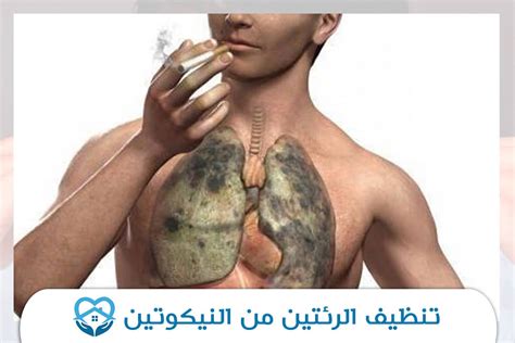 خطوات تساعدك على تخليص رئتيك من النيكوتين بشكل دائم