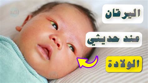 درجات اليرقان عند الأطفال حديثي الولادة ومتى تكون خطيرة