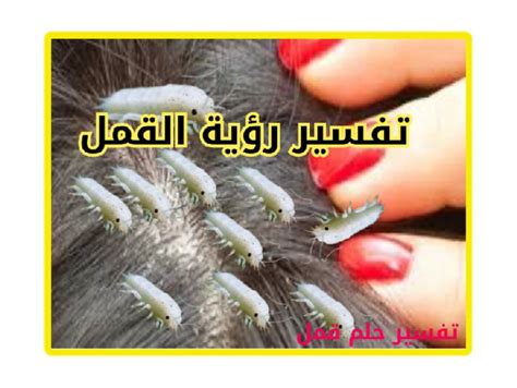رؤية القمل في المنام للنساء العازبات والمتزوجات والحوامل - تفسير الأحلام