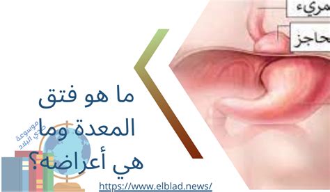 سؤال: ما هو الحامض المعدني في المعدة وما وظيفته؟