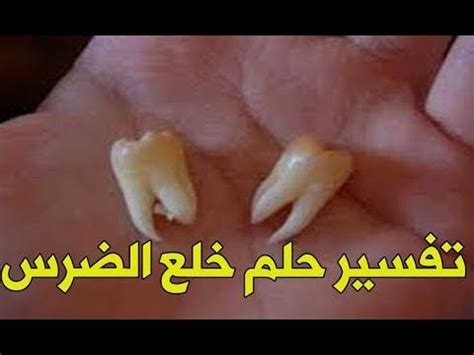 سقوط ضرس في المنام لامرأة متزوجة من ابن شاهين