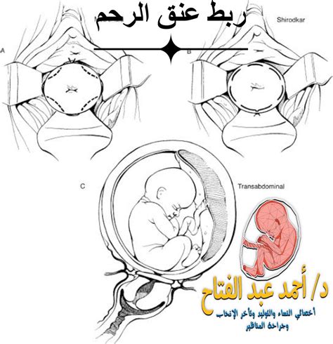 شرح كيفية استثمار العطل والمناسبات في ربط الرحم