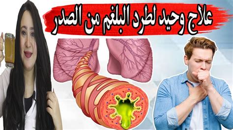 طرد البلغم طرد البلغم